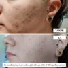 Flow Cosmetics – AHA & BHA Peeling Serum resultaten