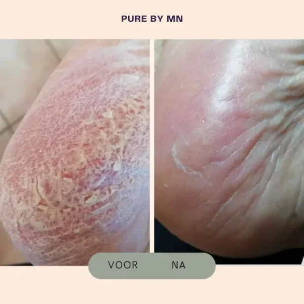 Voetenbalsem