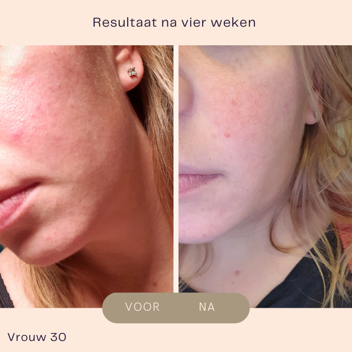 Problemen verholpen door Verzorgingnatuurlijk
